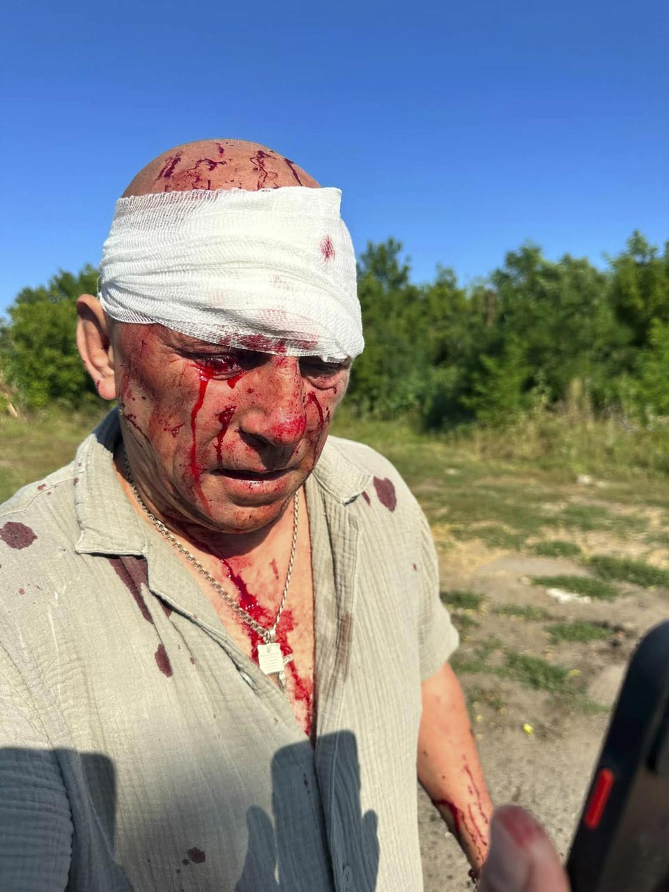 Наслідки обстрілу у Харківській області 2026-08-11